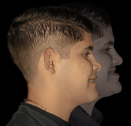 Tratamiento — Dr. Arquímedes Cantorán