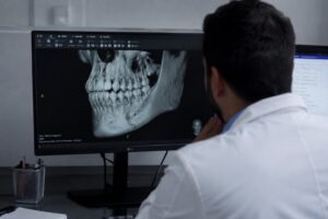 Fractura de mandíbula: tratamiento y reconstrucción de urgencia en Monterrey